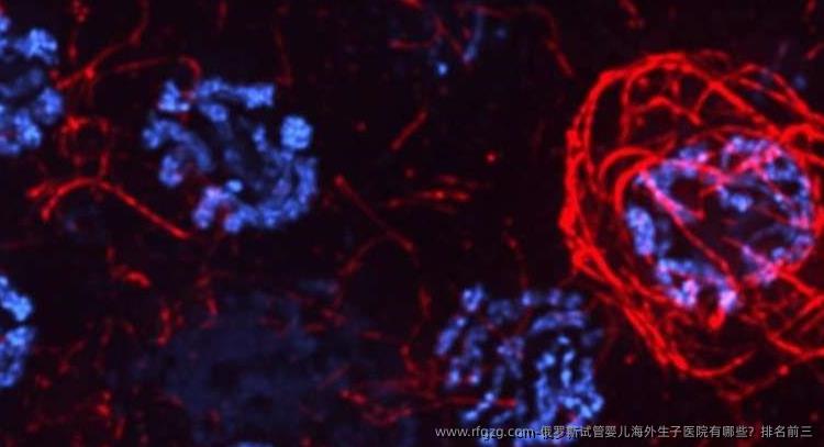 俄罗斯代孕海外生子医院有哪些？排名前三