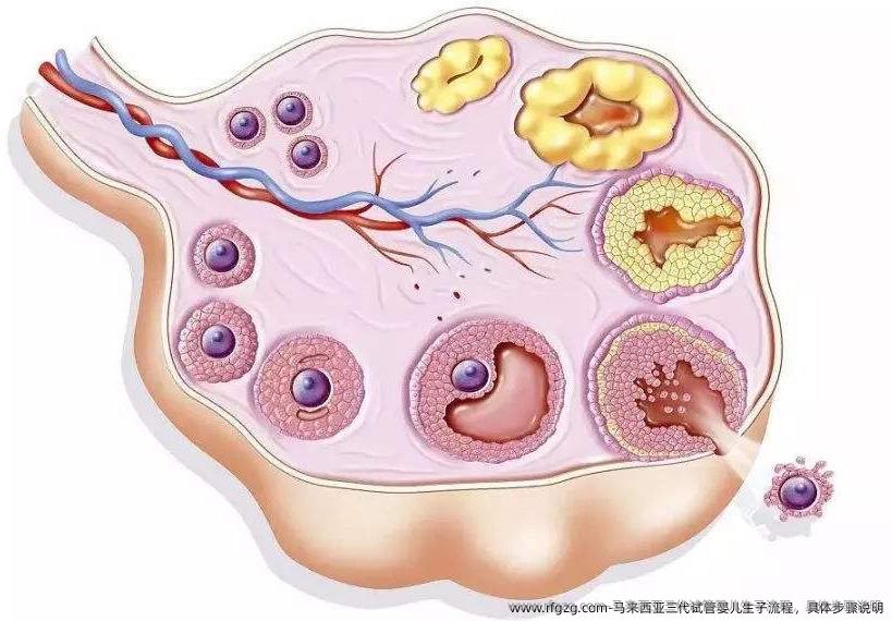 马来西亚三代代孕生子流程，具体步骤说明