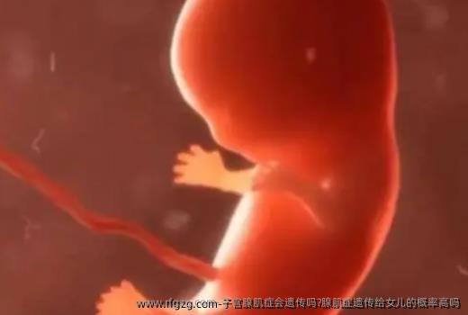 子宫腺肌症会遗传吗?腺肌症遗传给女儿的概率高吗