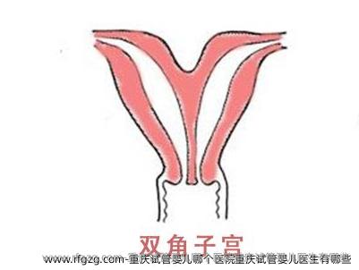 重庆代孕哪个医院重庆代孕医生有哪些
