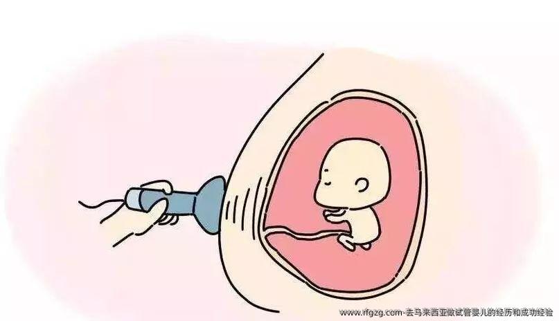 去马来西亚做代孕的经历和成功经验