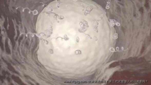 鱼鳞病遗传吗？第三代代孕可以避免吗？