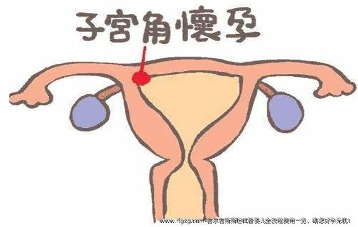吉尔吉斯斯坦代孕全流程费用一览，助您好孕无忧！