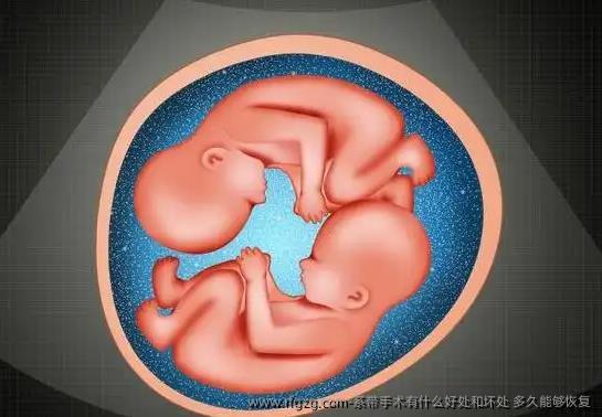 系带手术有什么好处和坏处 多久能够恢复