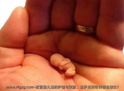 代孕后的护理与恢复，哈萨克斯坦有哪些建议？ 